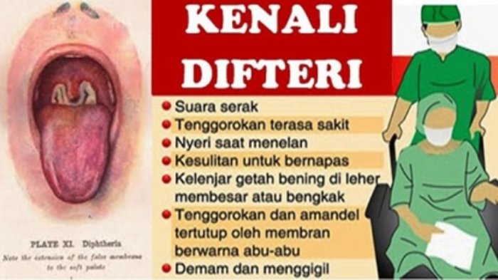 Kemenkes Rilis Buku Pedoman Pencegahan Dan Penanggulangan Difteri ...